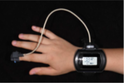 apparecchio per rilevazione di OSAS